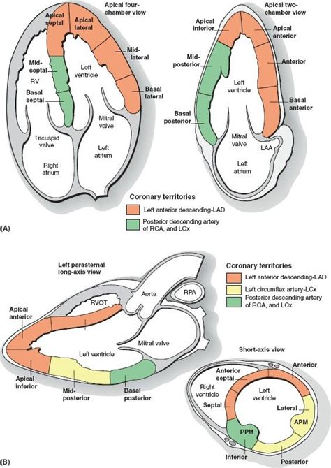 echo wall segments labeled.